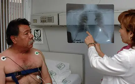 Imss