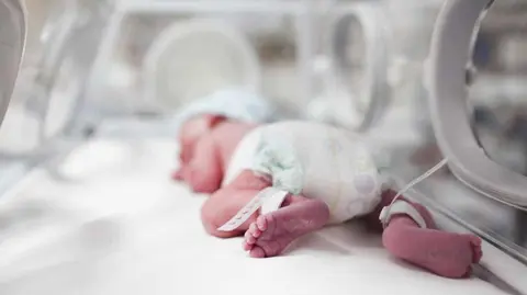 bebe prematuro nacimiento