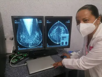 Salud Guanajuato detecta 69 casos de c&aacute;ncer de mama en el 2025