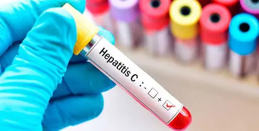 hepatitis