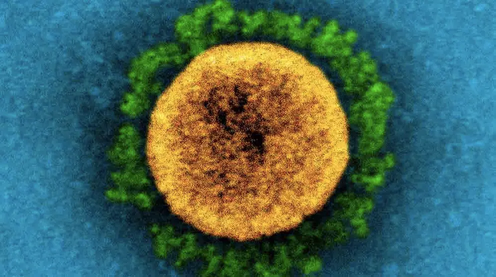 coronavirus