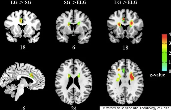 Brain on Love