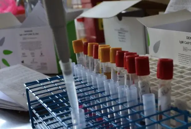 virus salud laboratorio